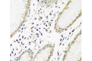 Immunohistochemistry of paraffin-embedded Human stomach using PYCR1 Polyclonal Antibody at dilution of 1:200 (40x lens). (PYCR1 anticorps)