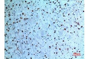 Immunohistochemistry (IHC) analysis of paraffin-embedded Mouse Brain, antibody was diluted at 1:100. (KRT14 anticorps  (C-Term))
