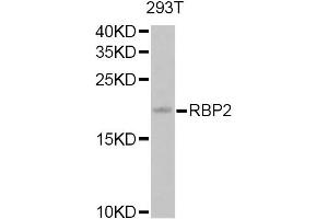 Western blot analysis of extracts of 293T cells, using RBP2 Antibody. (RBP2 anticorps)