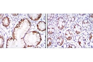 Immunohistochemical analysis of paraffin-embedded stomach tissues (left) and colon tissues (right) using CA9 mouse mAb with DAB staining. (CA9 anticorps)