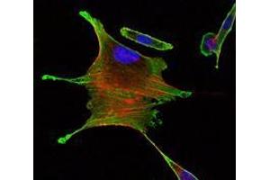 Immunofluorescence analysis of Eca109 cells using BMPR2 mouse mAb (green).
