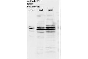Western blot for anti-hnRNP-L on HeLa cell extracts (HNRNPL anticorps)