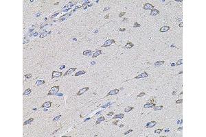Immunohistochemistry of paraffin-embedded Rat brain using TMC1 Polyclonal Antibody at dilution of 1:100 (40x lens).