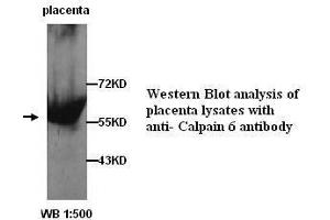 Image no. 1 for anti-Calpain 6 (CAPN6) (C-Term) antibody (ABIN790874) (Calpain 6 anticorps  (C-Term))