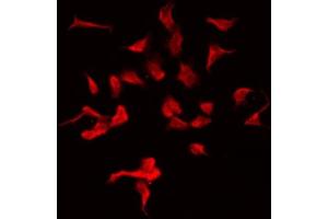 ABIN6275426 staining HeLa by IF/ICC. (MOV10L1 anticorps  (Internal Region))