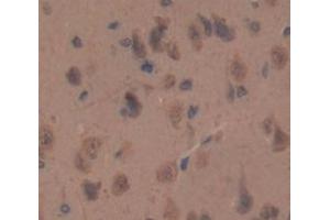 Used in DAB staining on fromalin fixed paraffin- embedded Kidney tissue