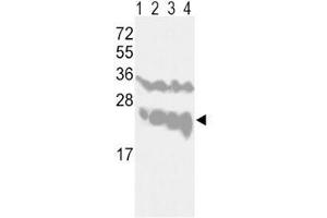 Western blot analysis of PGP9. (UCHL1 anticorps  (AA 16-46))