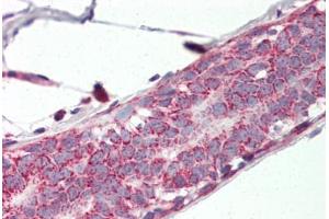 Human Breast (formalin-fixed, paraffin-embedded) stained with PHB2 antibody ABIN337044 at 5 ug/ml followed by biotinylated goat anti-rabbit IgG secondary antibody ABIN481713, alkaline phosphatase-streptavidin and chromogen. (Prohibitin 2 anticorps  (AA 88-299))