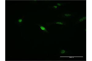 Immunofluorescence of monoclonal antibody to MEOX1 on HeLa cell. (MEOX1 anticorps  (AA 82-170))