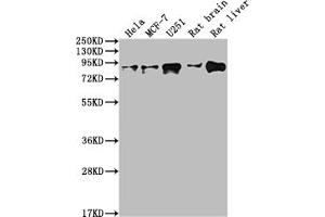 Western Blot Positive WB detected in: Hela whole cell lysate, MCF-7 whole cell lysate, U251 whole cell lysate, Rat brain tissue, Rat liver tissue All lanes: VCP antibody at 1:2000 Secondary Goat polyclonal to rabbit IgG at 1/50000 dilution Predicted band size: 90 kDa Observed band size: 90 kDa (Recombinant VCP anticorps)