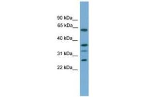 Image no. 1 for anti-Apolipoprotein L, 2 (APOL2) (C-Term) antibody (ABIN6746314) (Apolipoprotein L 2 anticorps  (C-Term))