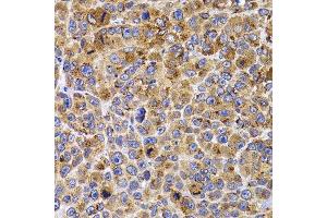 Immunohistochemistry of paraffin-embedded mouse cancer using UBE2R2 antibody.