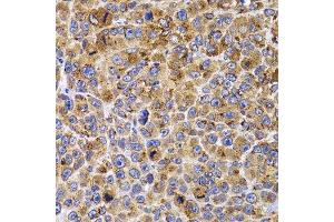 Immunohistochemistry of paraffin-embedded mouse cancer using UBE2R2 antibody. (UBE2R2 anticorps  (AA 1-238))