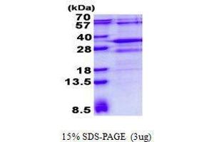 Figure annotation denotes ug of protein loaded and % gel used. (RSG1 Protéine)