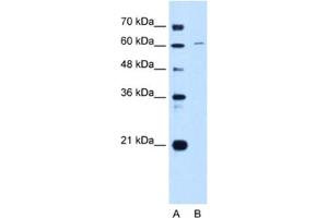 Western Blotting (WB) image for anti-Chromatin Licensing and DNA Replication Factor 1 (CDT1) antibody (ABIN2462973) (CDT1 anticorps)