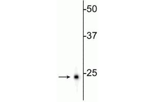 Western blot of rat hippocampal homogenate showing specific immunolabeling of the (UCHL1 anticorps)