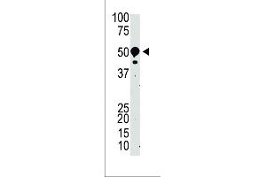 The anti-SUV39H2 Pab (ABIN388081 and ABIN2845969) is used in Western blot to detect SUV39H2 in mouse kidney tissue lysate.