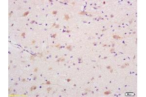 Formalin-fixed and paraffin embedded rat brain labeled with Rabbit Anti DEDD1 Polyclonal Antibody, Unconjugated  at 1:200 followed by conjugation to the secondary antibody and DAB staining (DEDD anticorps  (AA 151-250))