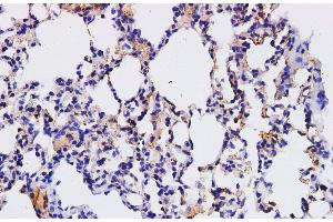 Immunohistochemistry of paraffin-embedded Mouse lung using HPGD Polyclonal Antibody at dilution of 1:200 (HPGD anticorps)