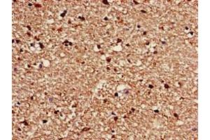 Immunohistochemistry of paraffin-embedded human brain tissue using ABIN7175571 at dilution of 1:100