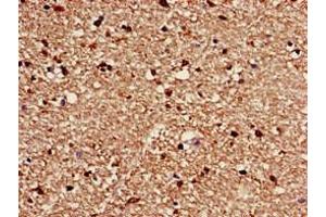 Immunohistochemistry of paraffin-embedded human brain tissue using ABIN7175571 at dilution of 1:100 (CACNG3 anticorps  (AA 235-315))