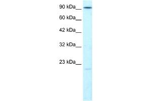 WB Suggested Anti-LIG4 Antibody Titration:  1. (LIG4 anticorps  (N-Term))