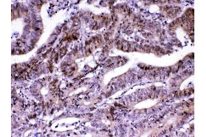 IHC analysis of MED18 using anti-MED18 antibody . (MED18 anticorps  (AA 1-208))
