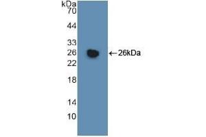 Detection of Recombinant GSTm1, Human using Polyclonal Antibody to Glutathione S Transferase Mu 1 (GSTM1) (GSTM1 anticorps  (AA 1-218))