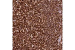Immunohistochemical staining of human tonsil with OR6P1 polyclonal antibody  shows strong cytoplasmic positivity in germinal and non-germinal center cells at 1:20-1:50 dilution. (OR6P1 anticorps)