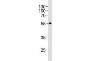 Western blot analysis of lysate from WiDr cell line using PDX1 at 1:1000.