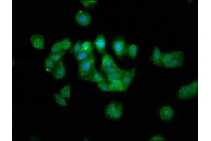 Immunofluorescence staining of HepG2 cells with ABIN7159750 at 1:133, counter-stained with DAPI. (MAP1A anticorps  (AA 1979-2168))