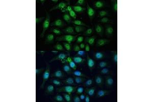 Immunofluorescence analysis of HeLa cells using ZWINT Polyclonal Antibody (ABIN6128944, ABIN6150552, ABIN6150554 and ABIN6221938) at dilution of 1:100 (40x lens).