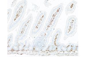Immunohistochemistry (IHC) image for anti-Thrombomodulin (THBD) (AA 17-517) antibody (ABIN7795655)