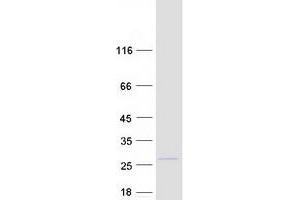 Validation with Western Blot