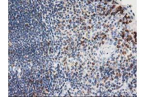 Image no. 3 for anti-Protein tyrosine Phosphatase, Non-Receptor Type 1 (PTPN1) antibody (ABIN1500496)