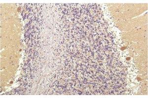 Immunohistochemistry of paraffin-embedded Human brain tissue using SGK1 Monoclonal Antibody at dilution of 1:200.