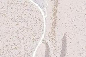 Immunohistochemistry analysis of paraffin-embedded mouse substantia nigra using TBXT (ABIN7075815) at dilution of 1: 3200