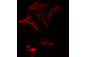 ABIN6274865 staining Hela cells by IF/ICC. (Arylsulfatase A anticorps  (Internal Region))
