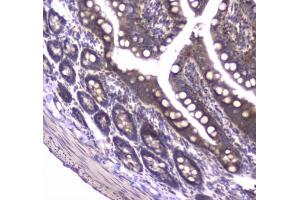 IHC testing of FFPE rat small intestine tissue with MVP antibody at 1ug/ml. (MVP anticorps)