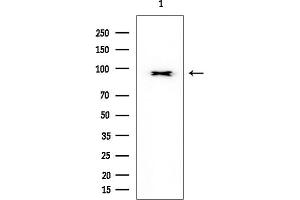 Western blot analysis of lysates from HUVEC cells, using AhR Mouse Monoclonal Antibody at 1/1000 dilution.