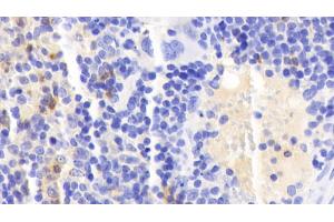 Detection of CAMP in Mouse Spleen Tissue using Polyclonal Antibody to Cathelicidin Antimicrobial Peptide (CAMP)