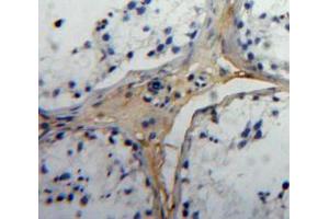 Used in DAB staining on fromalin fixed paraffin-embedded Testis tissue
