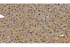 Detection of TICAM1 in Mouse Liver Tissue using Polyclonal Antibody to Toll Like Receptor Adaptor Molecule 1 (TICAM1)