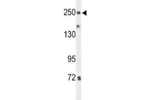 Western blot analysis of PTPRD antibody and HeLa lysate.