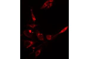 ABIN6266633 staining HepG2 cells by IF/ICC.