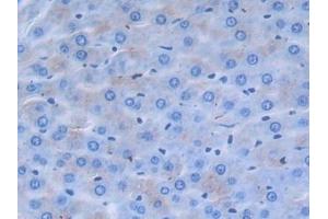 Detection of a2PI in Rat Liver Tissue using Polyclonal Antibody to Alpha 2-Antiplasmin (a2PI) (alpha 2 Antiplasmin anticorps  (AA 348-491))