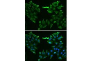 Immunofluorescence analysis of HeLa cell using SLC5A6 antibody. (SLC5A6 anticorps)