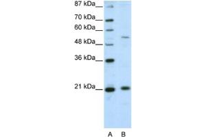 Western Blotting (WB) image for anti-Zinc Finger and SCAN Domain Containing 20 (ZSCAN20) antibody (ABIN2461978) (ZSCAN20 anticorps)