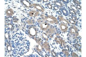 RSAD2 antibody was used for immunohistochemistry at a concentration of 4-8 ug/ml to stain Epithelial cells of renal tubule (arrows) in Human Kidney. (RSAD2 anticorps  (C-Term))