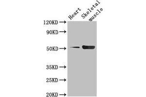Western Blot Positive WB detected in: Mouse heart tissue, Mouse skeletal muscle tissue All lanes: TPH1 antibody at 2.